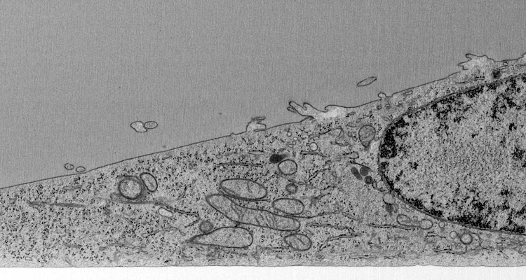 An electron micrograph: one slice through this HeLa cell, from the glass up. The cell membrane is at the top, the nucleus on the right, the cytoplasm in between, full of mitochondria and endoplasmic reticulum