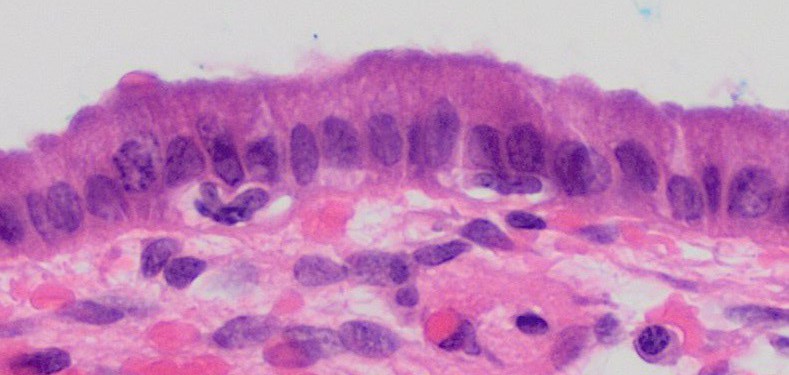 A closer photograph through a light microscope: tall lining cells side by side, each with its nucleus, and connective tissue below them