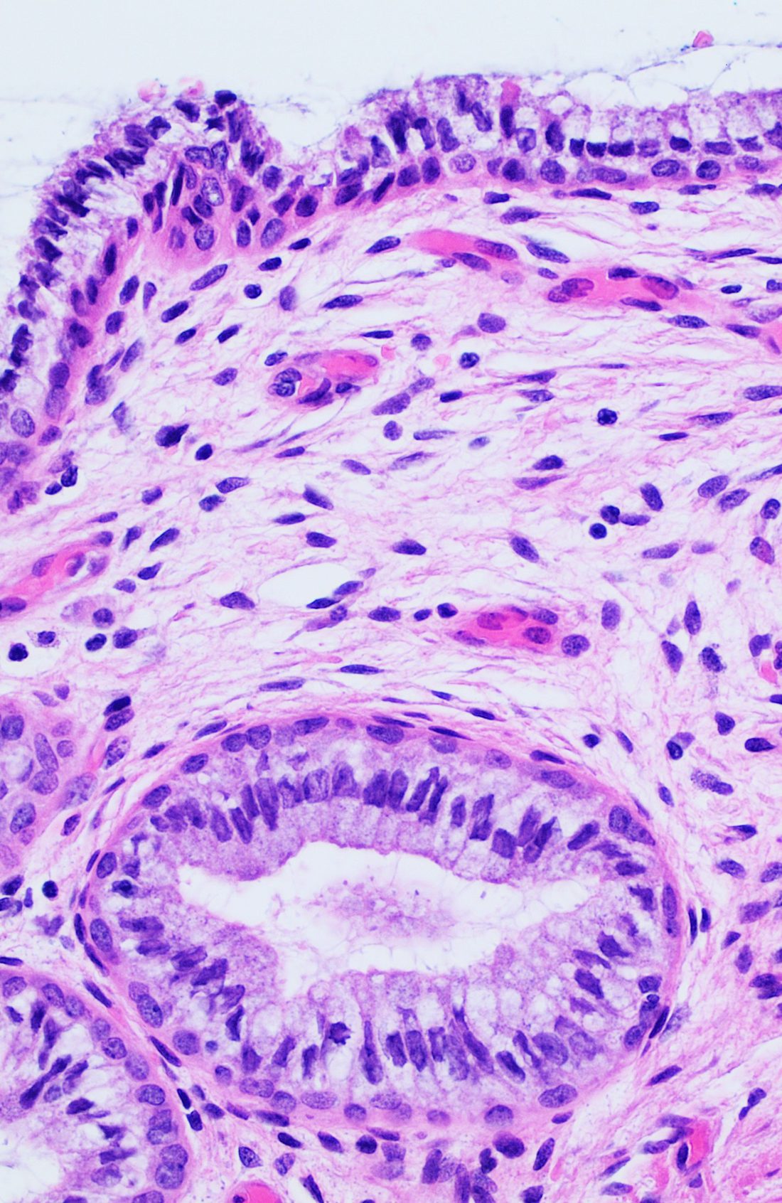 A photograph through a light microscope of the lining of the cervix, stained pink and purple